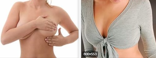 Как проводиться подтяжка груди