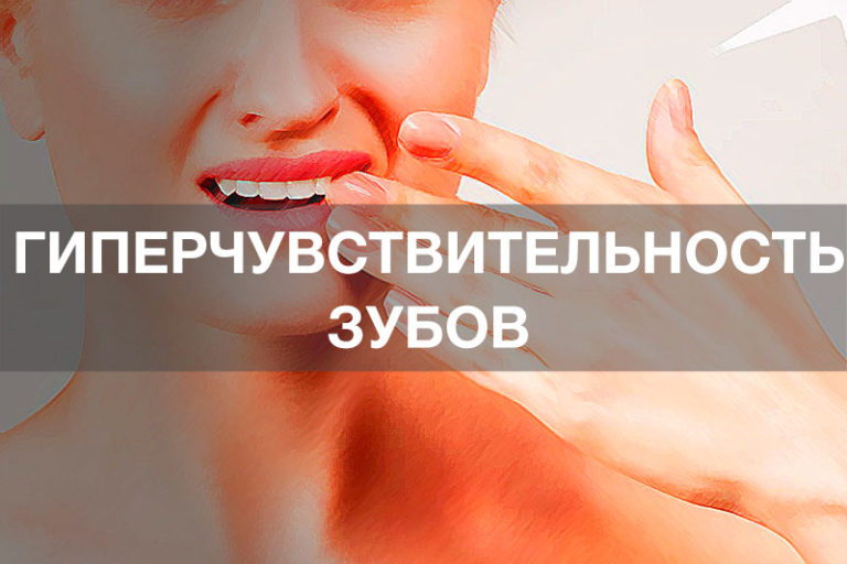 Гиперчувствительность зубов. В чем причина? Гиперчувствительность зубов. В чем причина?