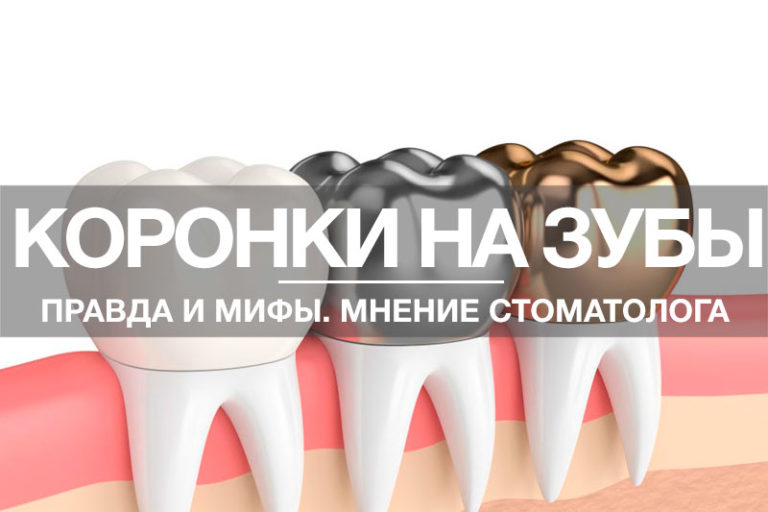Мифы о современных коронках! Мифы о современных коронках