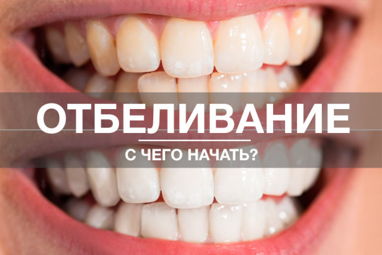 С чего начать, если Вы решили сделать отбеливание? если Вы решили сделать отбеливание