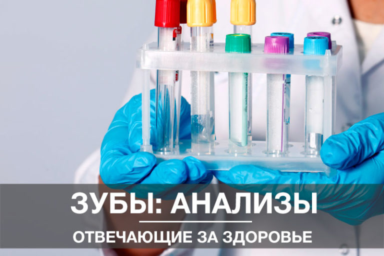 Анализы отвечающие за здоровье зубов Анализы отвечающие за здоровье зубов