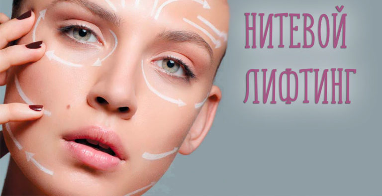 Как нитевой лифтинг борется с возрастным птозом? нитевой лифтинг