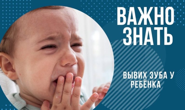 Вывих зуба у ребенка Вывих зуба у ребенка